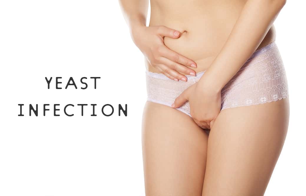 Yeast Infections And You: The Basic Facts